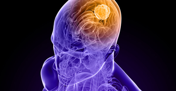 In Control Of Cancer