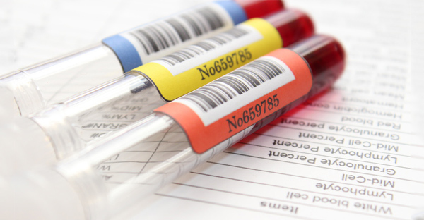 Should I be tested? Ask These 4 Questions First